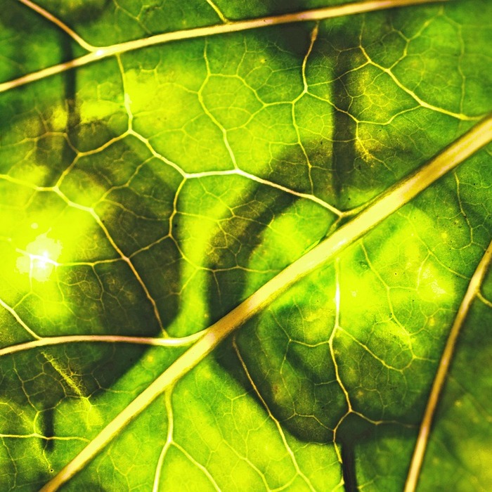 폐렴 엑스레이 소견