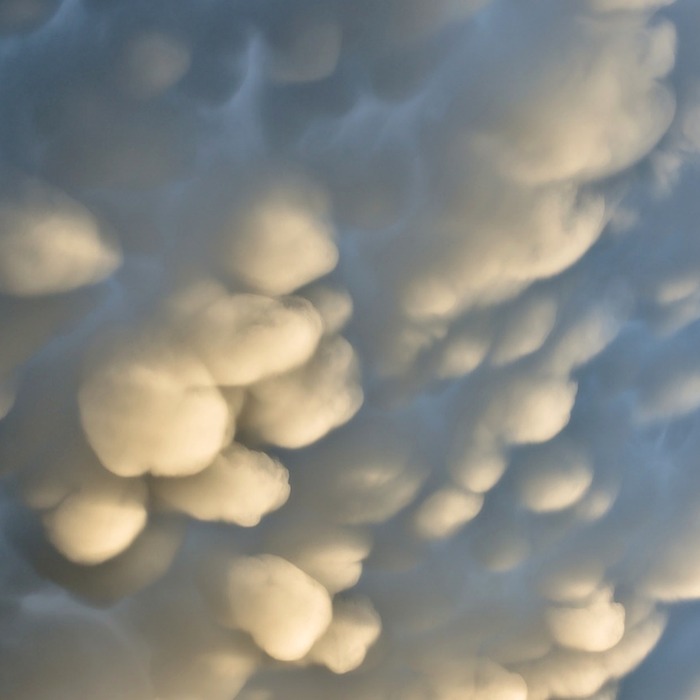 유방 양성석회화