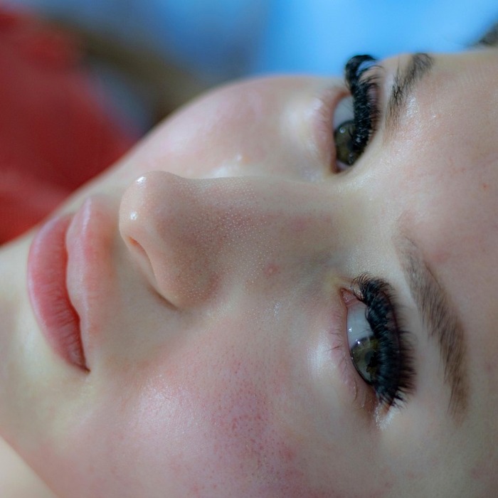 피부과 레이저 시술